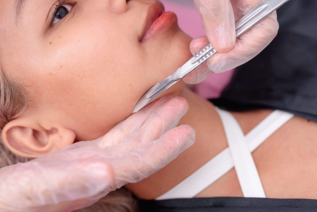 Effortless glowup - Is Dermaplaning Suitable for All Skin Types? Photo - A woman getting dermalplaning treatment